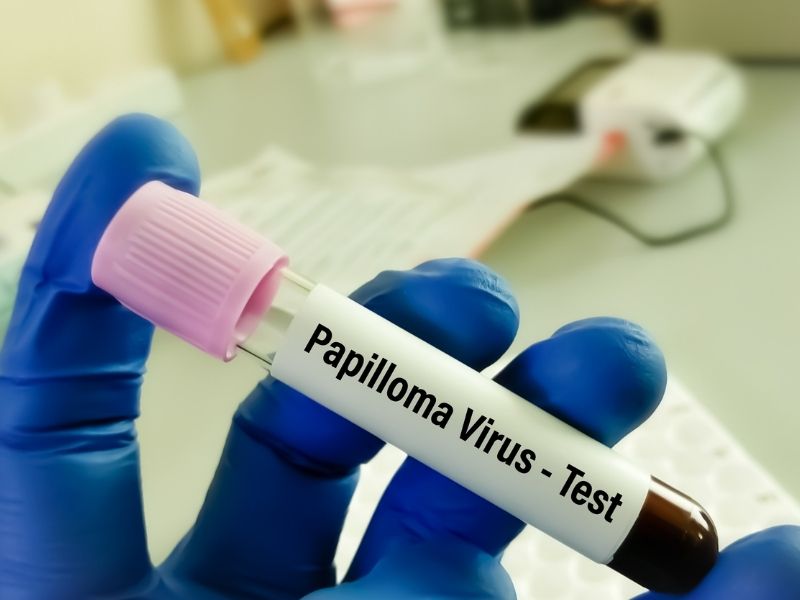 hpv-testi